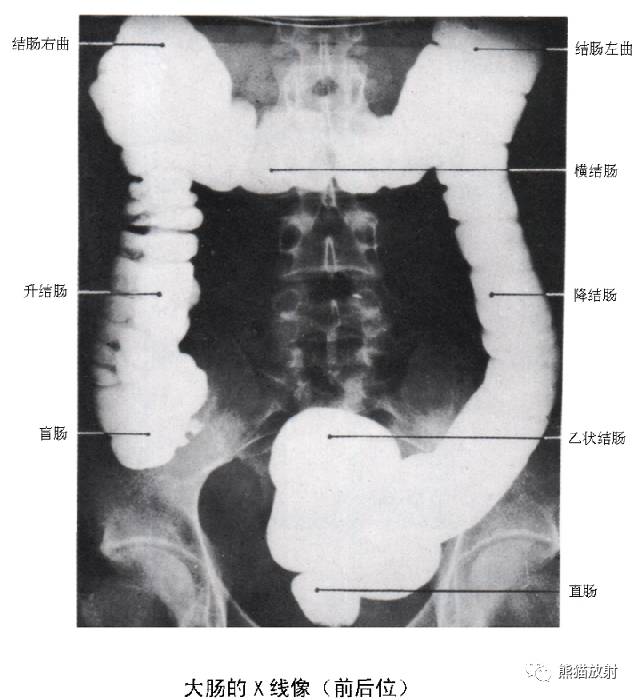 影像PPT - 详细的消化道造影+彩色解剖图-26 影像PPT - 详细的消化道造影+彩色解剖图-26