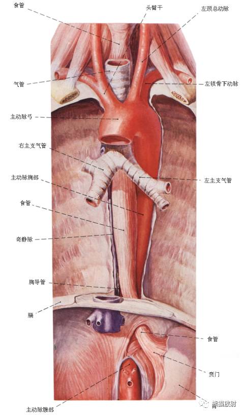 影像PPT - 详细的消化道造影+彩色解剖图-28 影像PPT - 详细的消化道造影+彩色解剖图-28