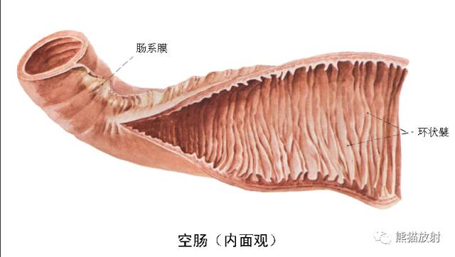 影像PPT - 详细的消化道造影+彩色解剖图-34 影像PPT - 详细的消化道造影+彩色解剖图-34