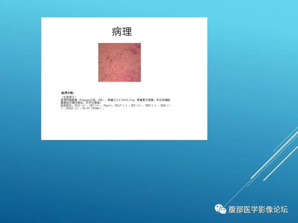影像PPT - 【病例】肾脏透明细胞癌1例MR影像-10
