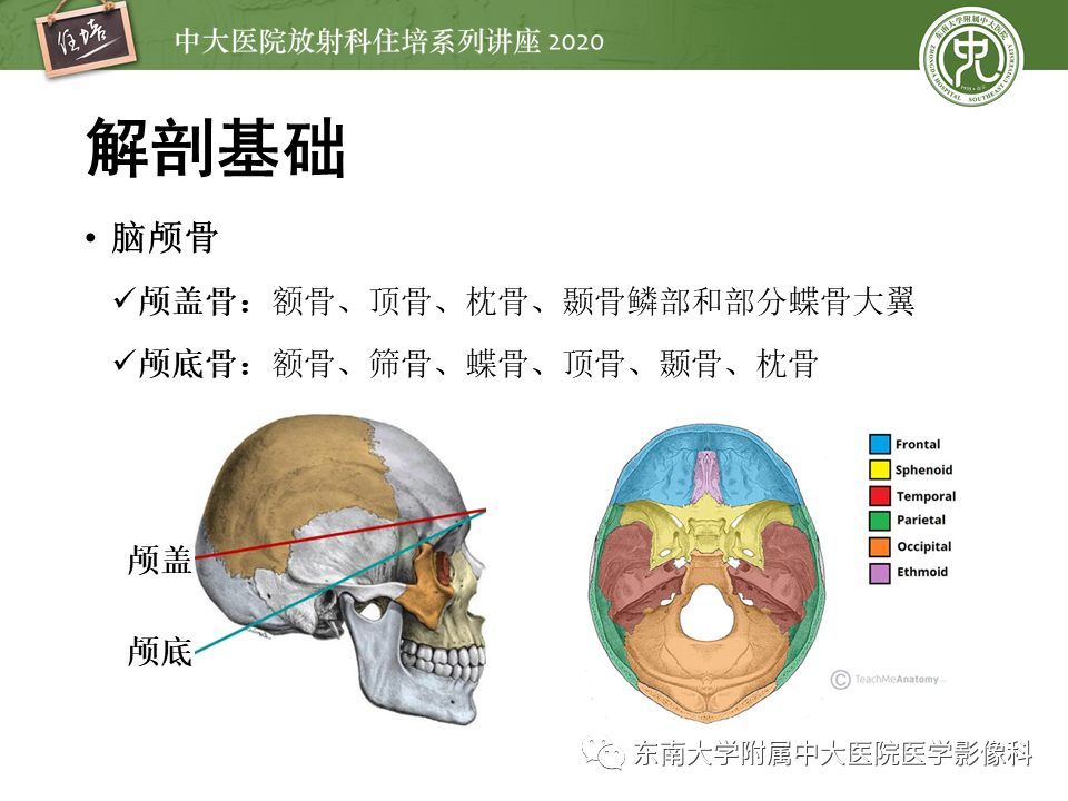 影像PPT - 【PPT】颅骨病变的影像诊断-3