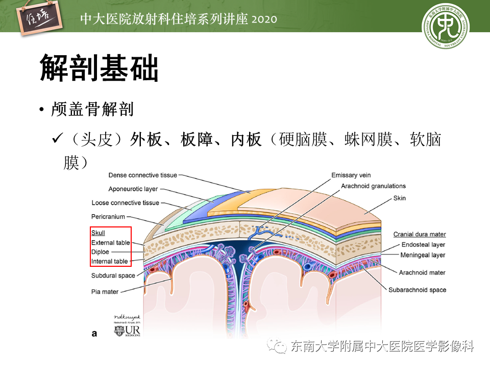 影像PPT - 【PPT】颅骨病变的影像诊断-4