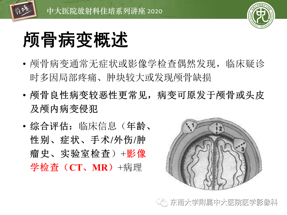 影像PPT - 【PPT】颅骨病变的影像诊断-6