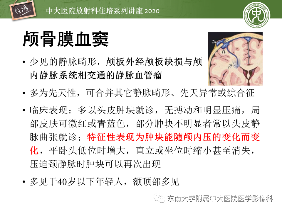 影像PPT - 【PPT】颅骨病变的影像诊断-25