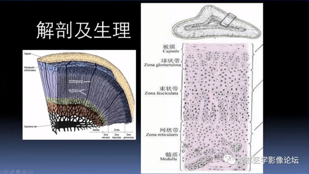 影像PPT - 【PPT】放射科在肾上腺疾病临床诊治中的作用-6