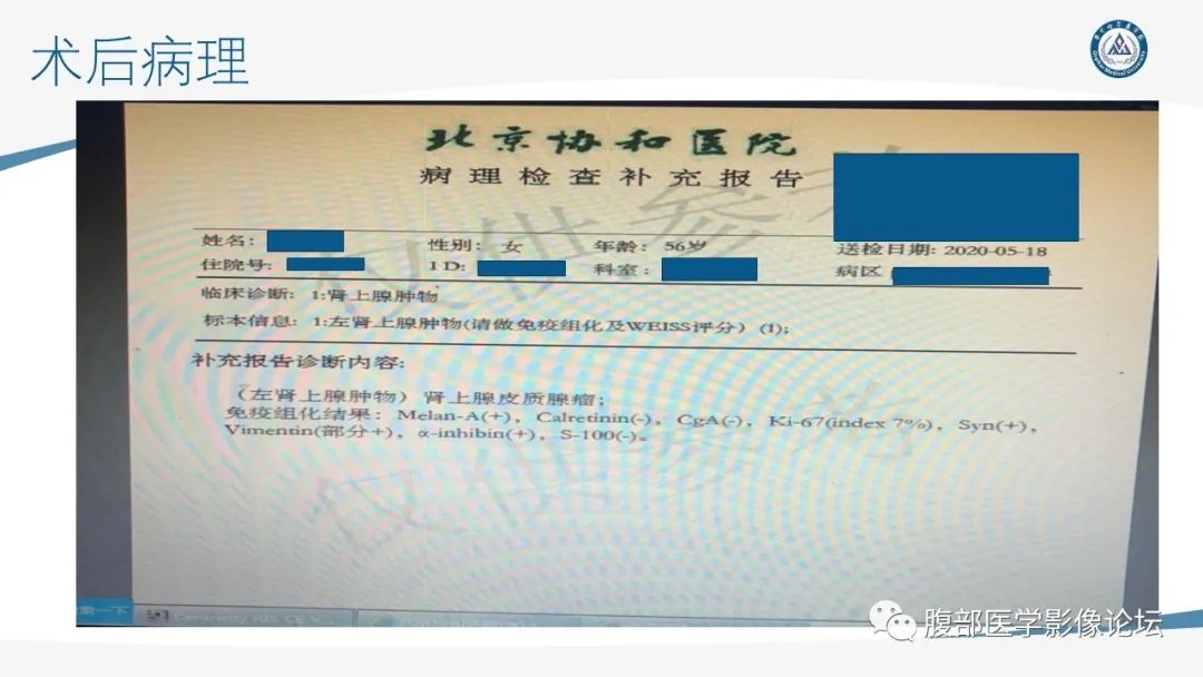 影像PPT - 【PPT】放射科在肾上腺疾病临床诊治中的作用-23