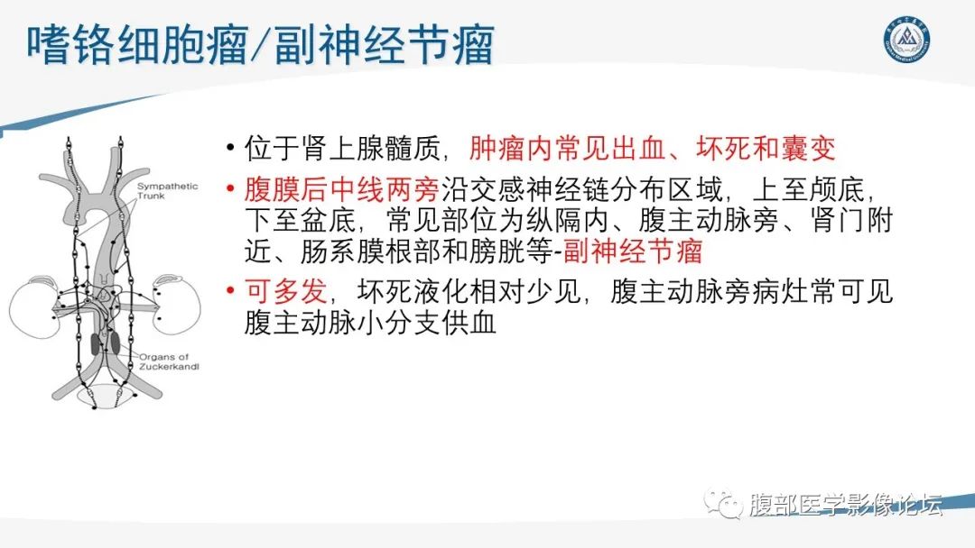 影像PPT - 【PPT】放射科在肾上腺疾病临床诊治中的作用-40