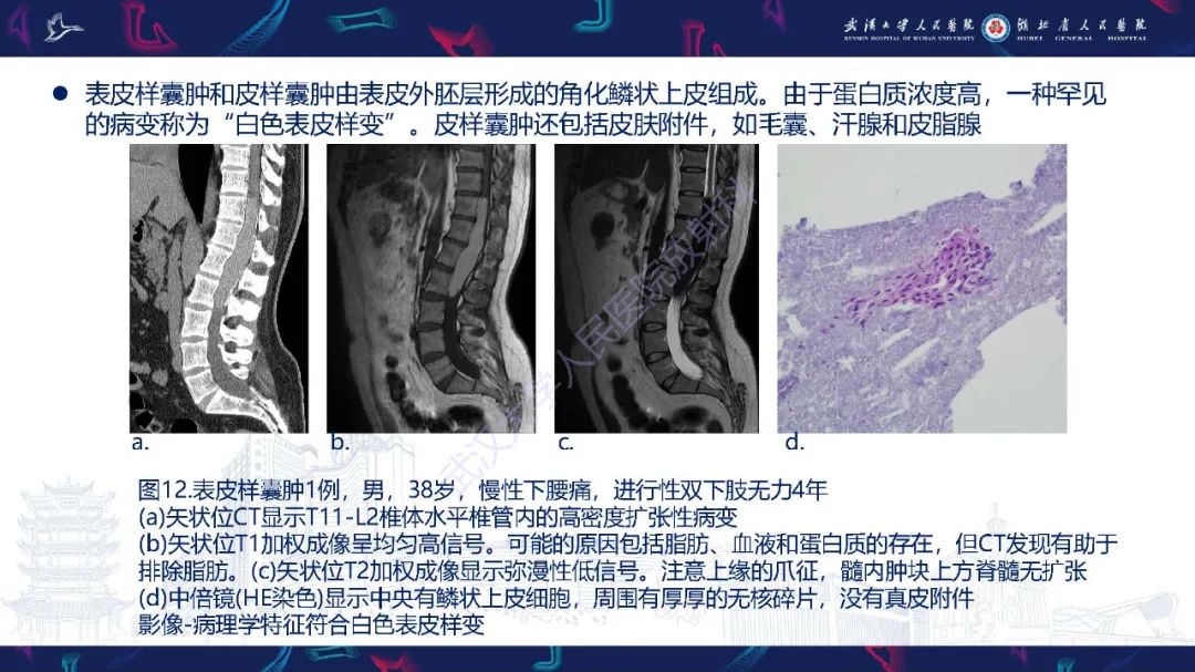 影像PPT - 【PPT】脊髓髓内占位影像诊断-37