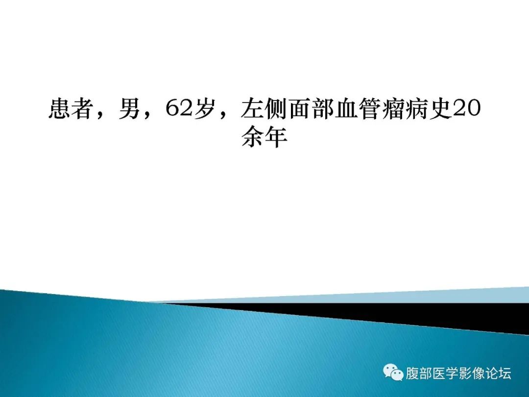 影像PPT - 【病例】脾脏血管瘤1例CT影像-2 影像PPT - 【病例】脾脏血管瘤1例CT影像-2