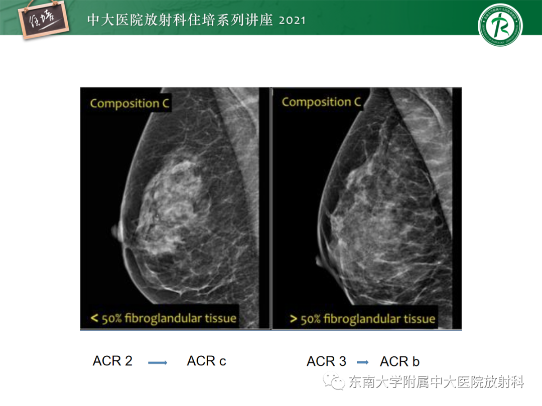 影像PPT - 【PPT】乳腺X线影像报告和数据系统（第五版）BI-RADS-4