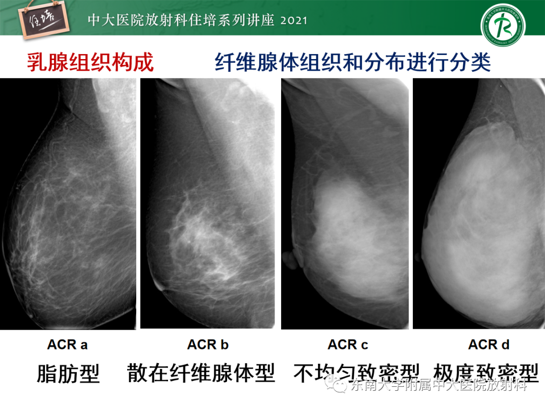 影像PPT - 【PPT】乳腺X线影像报告和数据系统（第五版）BI-RADS-5
