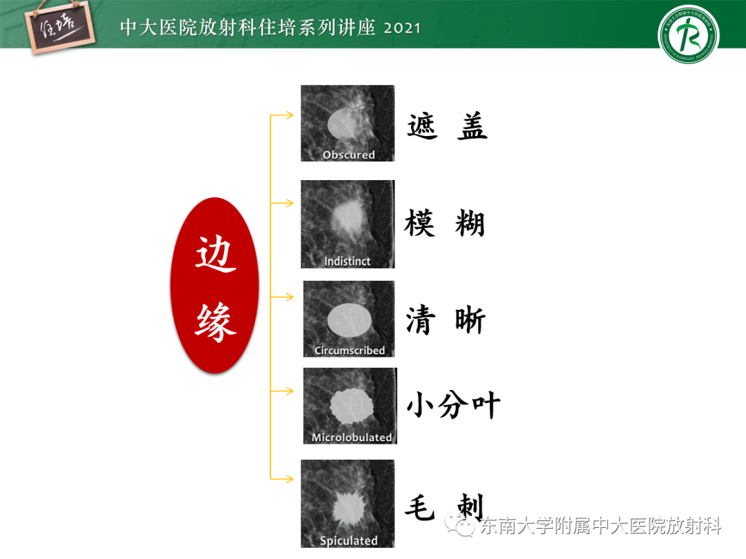 影像PPT - 【PPT】乳腺X线影像报告和数据系统（第五版）BI-RADS-11