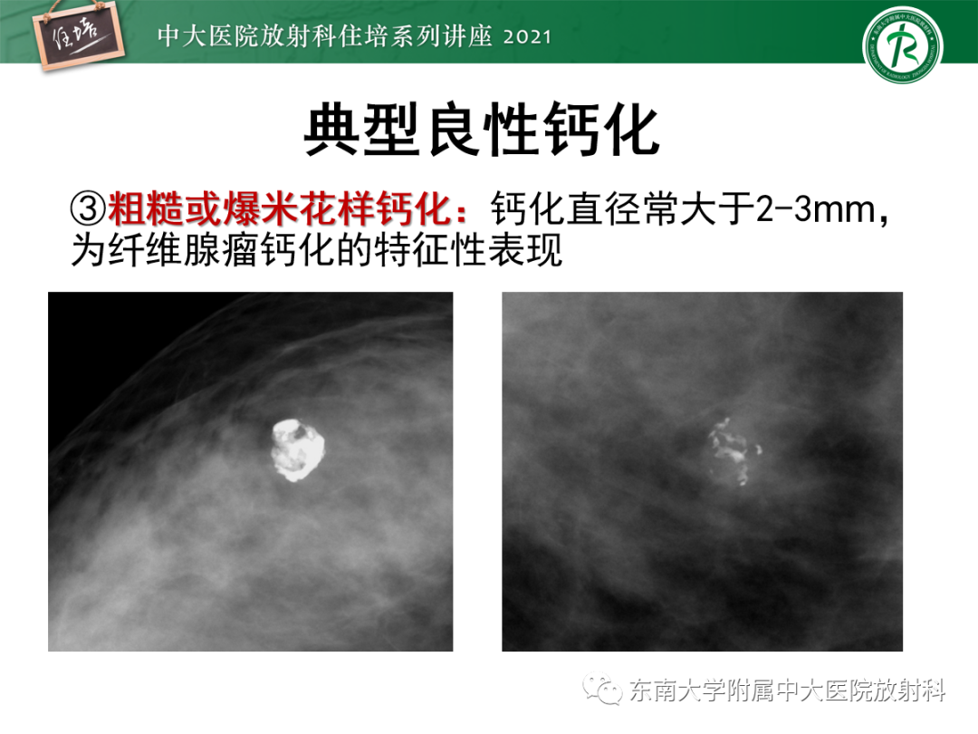 影像PPT - 【PPT】乳腺X线影像报告和数据系统（第五版）BI-RADS-21