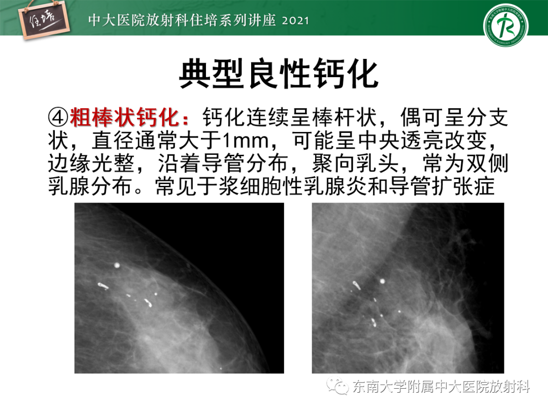 影像PPT - 【PPT】乳腺X线影像报告和数据系统（第五版）BI-RADS-22