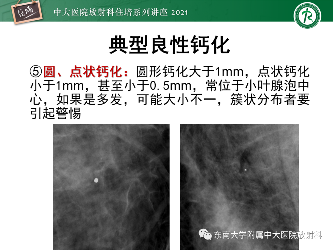 影像PPT - 【PPT】乳腺X线影像报告和数据系统（第五版）BI-RADS-23