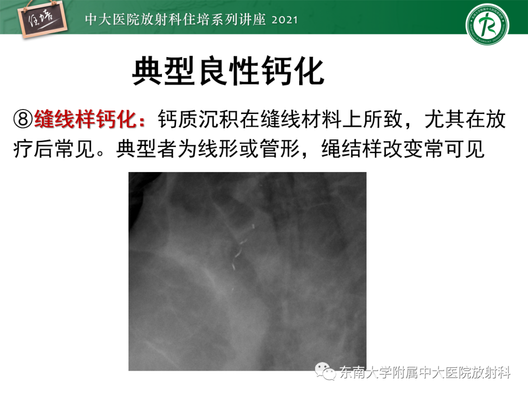 影像PPT - 【PPT】乳腺X线影像报告和数据系统（第五版）BI-RADS-26