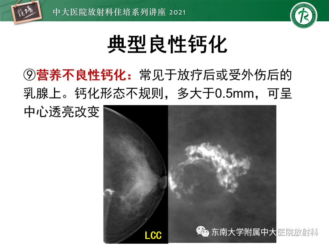 影像PPT - 【PPT】乳腺X线影像报告和数据系统（第五版）BI-RADS-27