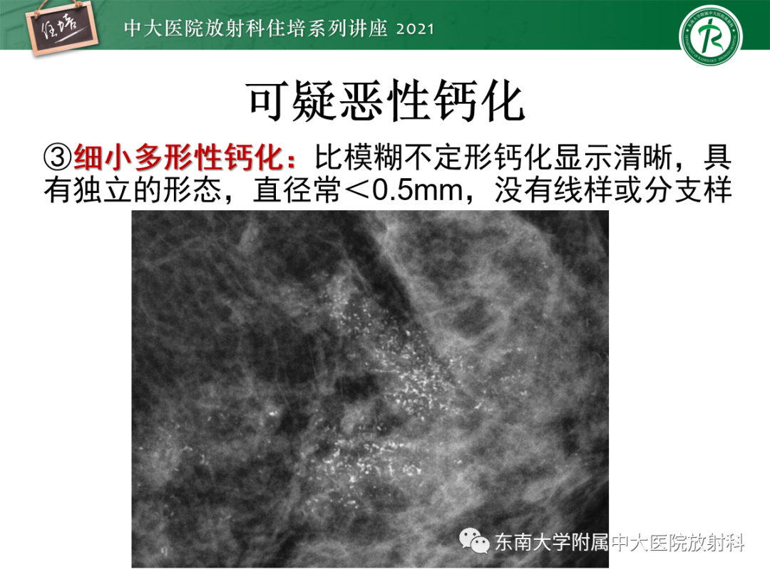 影像PPT - 【PPT】乳腺X线影像报告和数据系统（第五版）BI-RADS-31