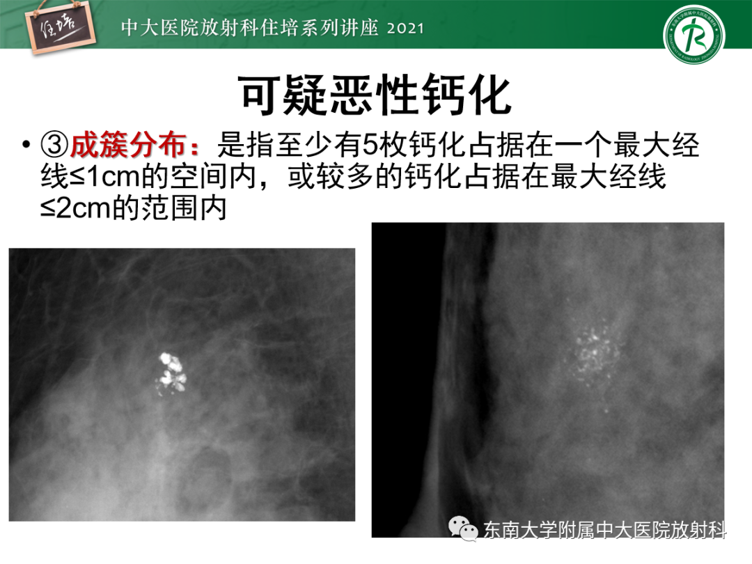 影像PPT - 【PPT】乳腺X线影像报告和数据系统（第五版）BI-RADS-36