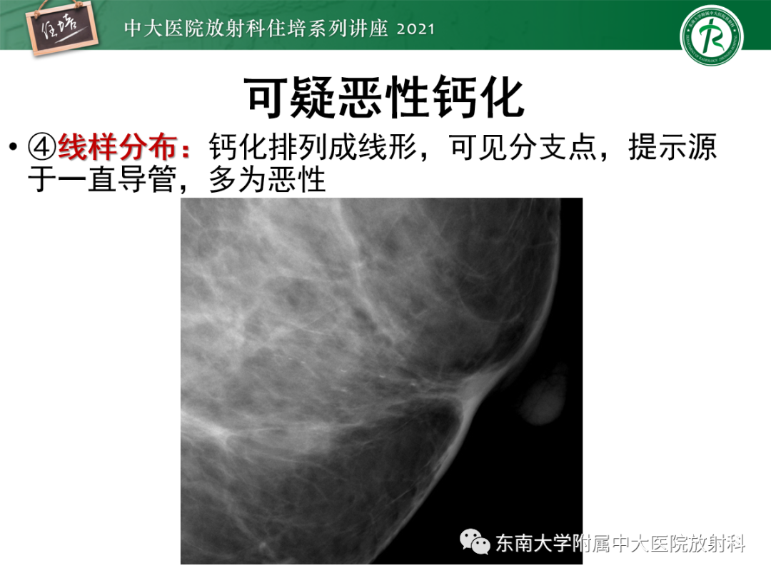 影像PPT - 【PPT】乳腺X线影像报告和数据系统（第五版）BI-RADS-37