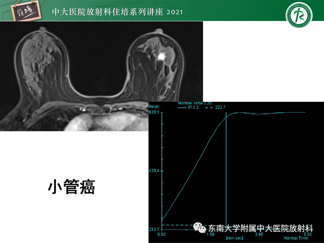 影像PPT - 【PPT】乳腺X线影像报告和数据系统（第五版）BI-RADS-49