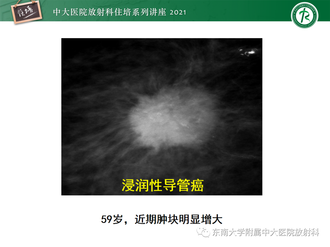 影像PPT - 【PPT】乳腺X线影像报告和数据系统（第五版）BI-RADS-70