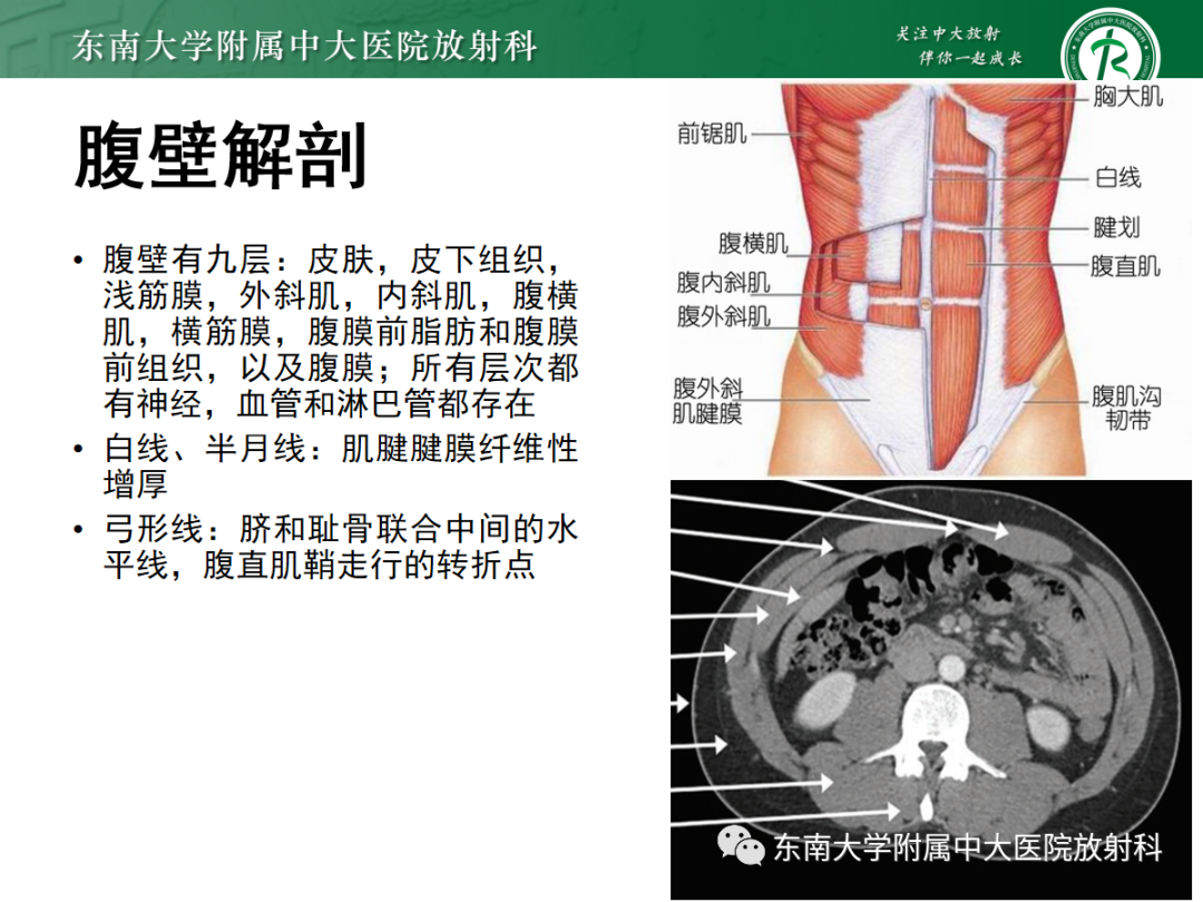 影像PPT - 【PPT】腹壁肿物的影像诊断思路-8 影像PPT - 【PPT】腹壁肿物的影像诊断思路-8