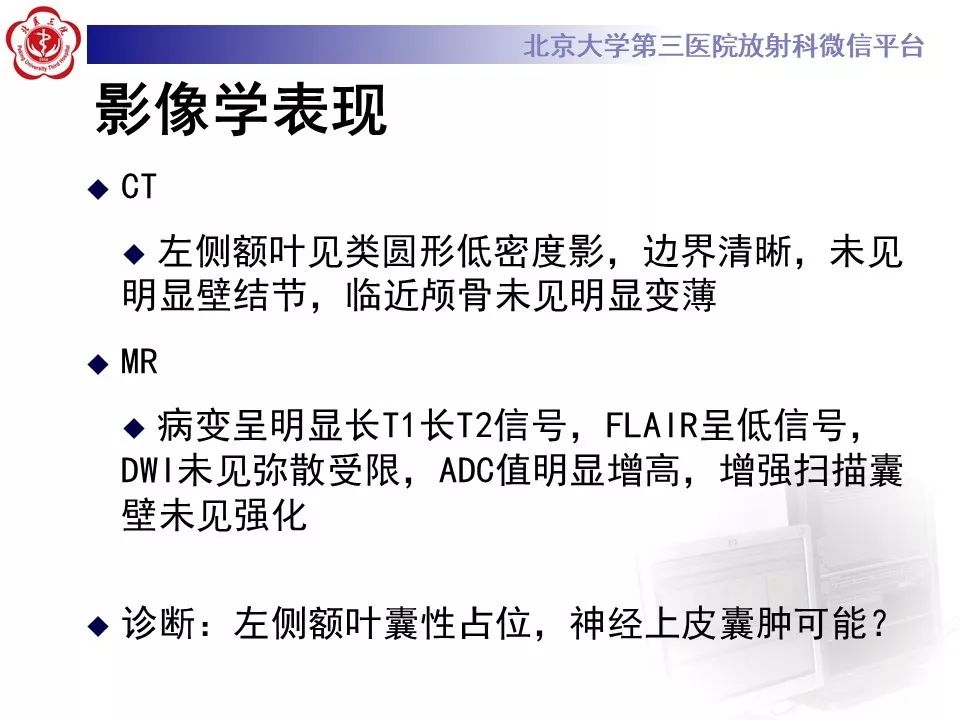 影像PPT - 【PPT】神经上皮囊肿影像-6