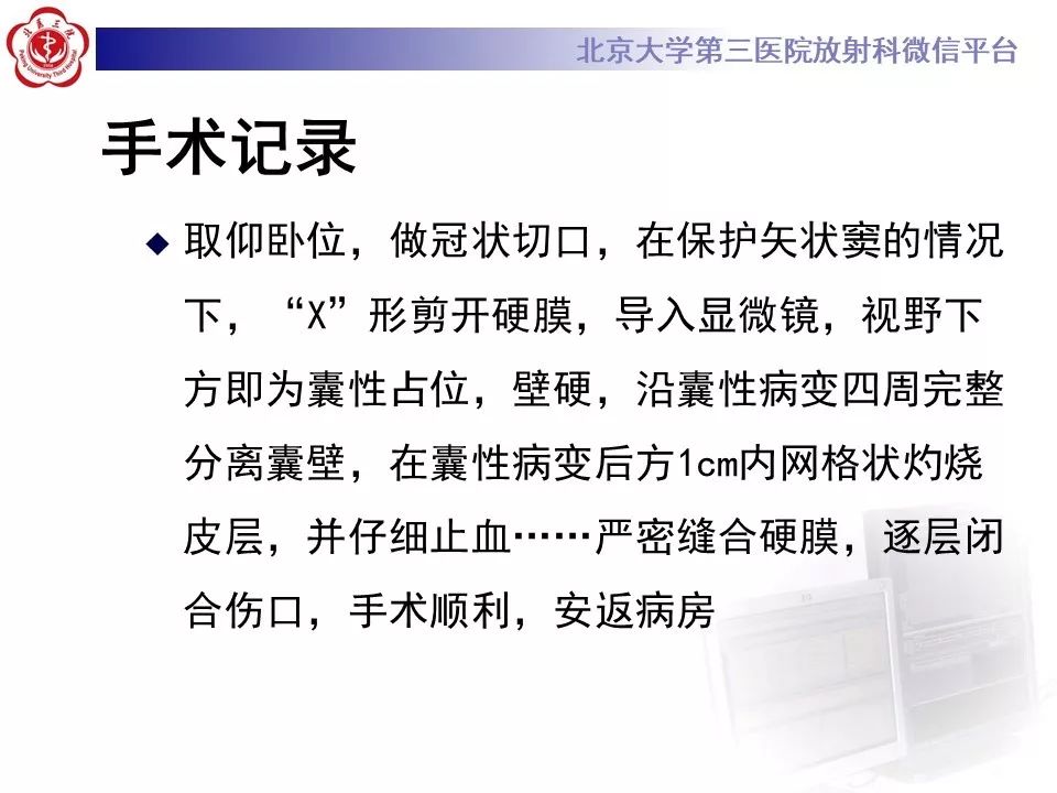 影像PPT - 【PPT】神经上皮囊肿影像-7