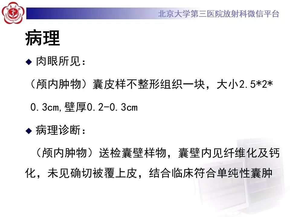 影像PPT - 【PPT】神经上皮囊肿影像-8