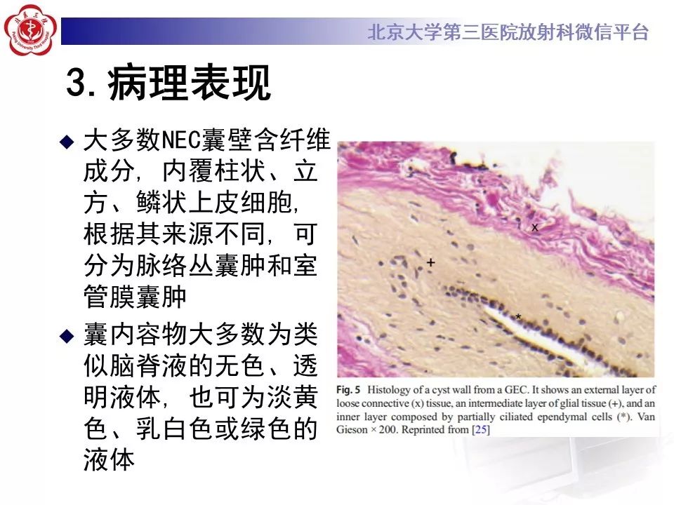 影像PPT - 【PPT】神经上皮囊肿影像-13