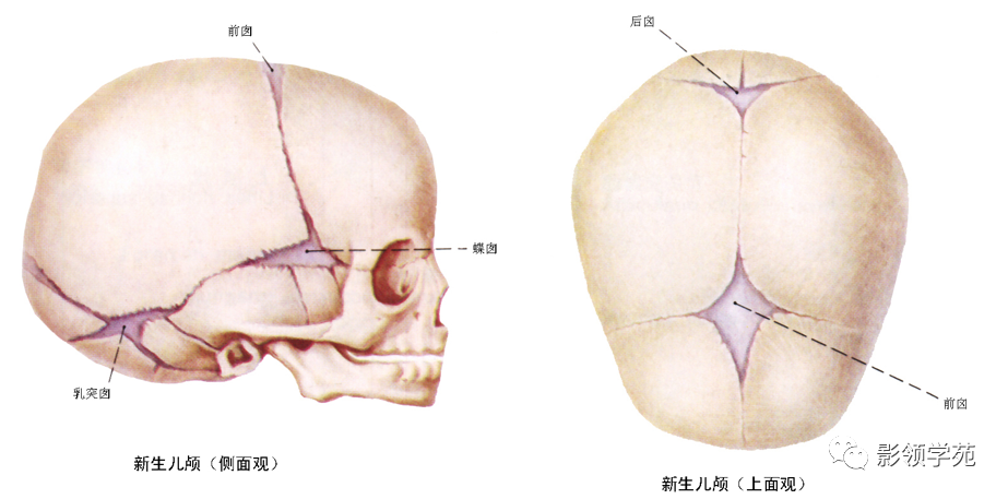 影像PPT - 新生儿颅脑MRI解剖及常见疾病影像表现-4 影像PPT - 新生儿颅脑MRI解剖及常见疾病影像表现-4