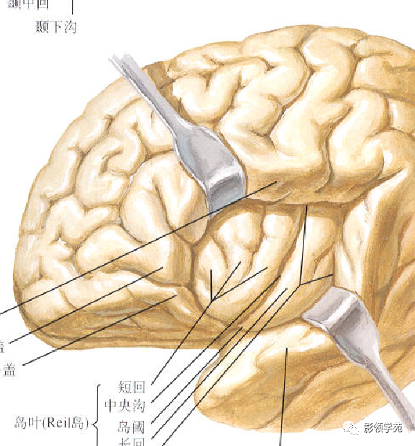 影像PPT - 新生儿颅脑MRI解剖及常见疾病影像表现-24 影像PPT - 新生儿颅脑MRI解剖及常见疾病影像表现-24