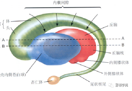 影像PPT - 新生儿颅脑MRI解剖及常见疾病影像表现-28 影像PPT - 新生儿颅脑MRI解剖及常见疾病影像表现-28