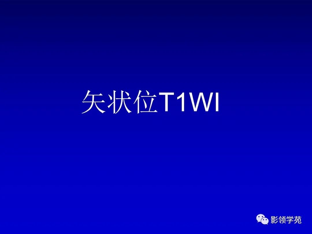 影像PPT - 新生儿颅脑MRI解剖及常见疾病影像表现-46 影像PPT - 新生儿颅脑MRI解剖及常见疾病影像表现-46