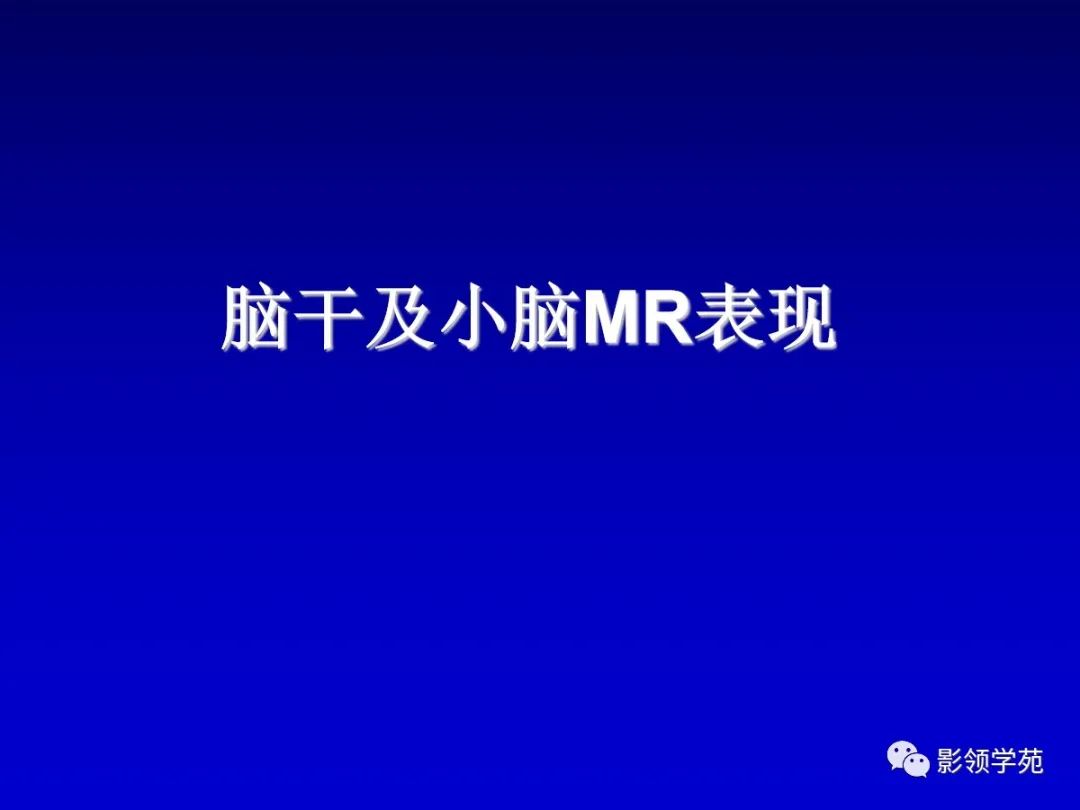 影像PPT - 新生儿颅脑MRI解剖及常见疾病影像表现-57 影像PPT - 新生儿颅脑MRI解剖及常见疾病影像表现-57