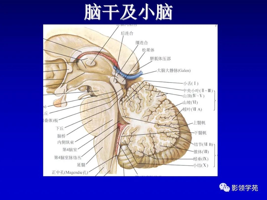 影像PPT - 新生儿颅脑MRI解剖及常见疾病影像表现-58 影像PPT - 新生儿颅脑MRI解剖及常见疾病影像表现-58