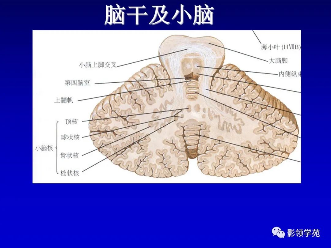 影像PPT - 新生儿颅脑MRI解剖及常见疾病影像表现-59 影像PPT - 新生儿颅脑MRI解剖及常见疾病影像表现-59
