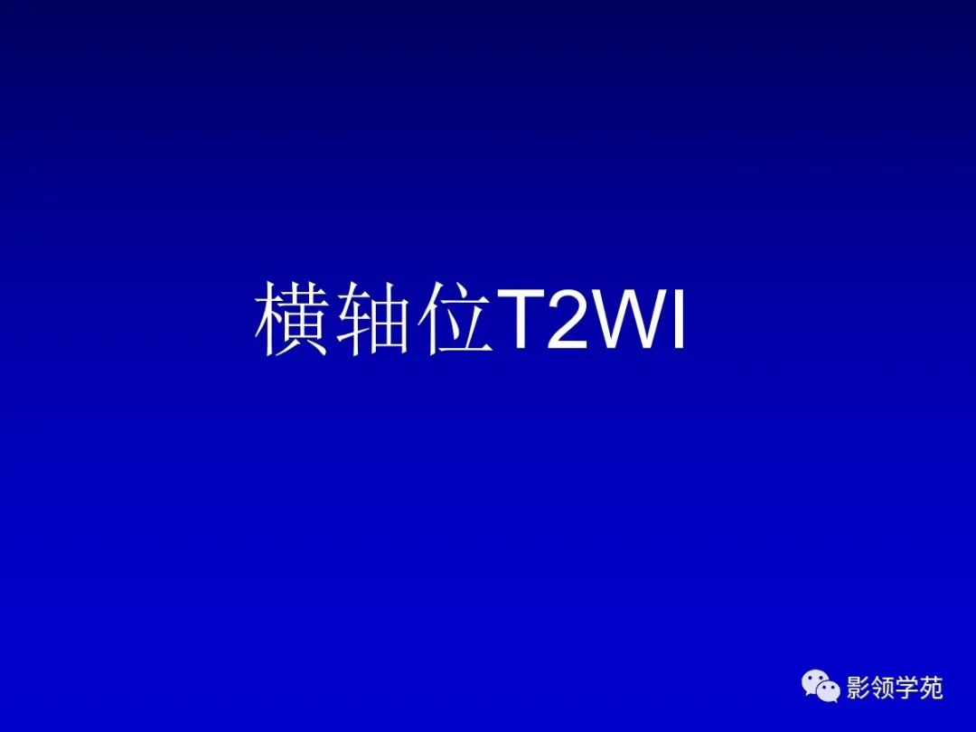 影像PPT - 新生儿颅脑MRI解剖及常见疾病影像表现-60 影像PPT - 新生儿颅脑MRI解剖及常见疾病影像表现-60