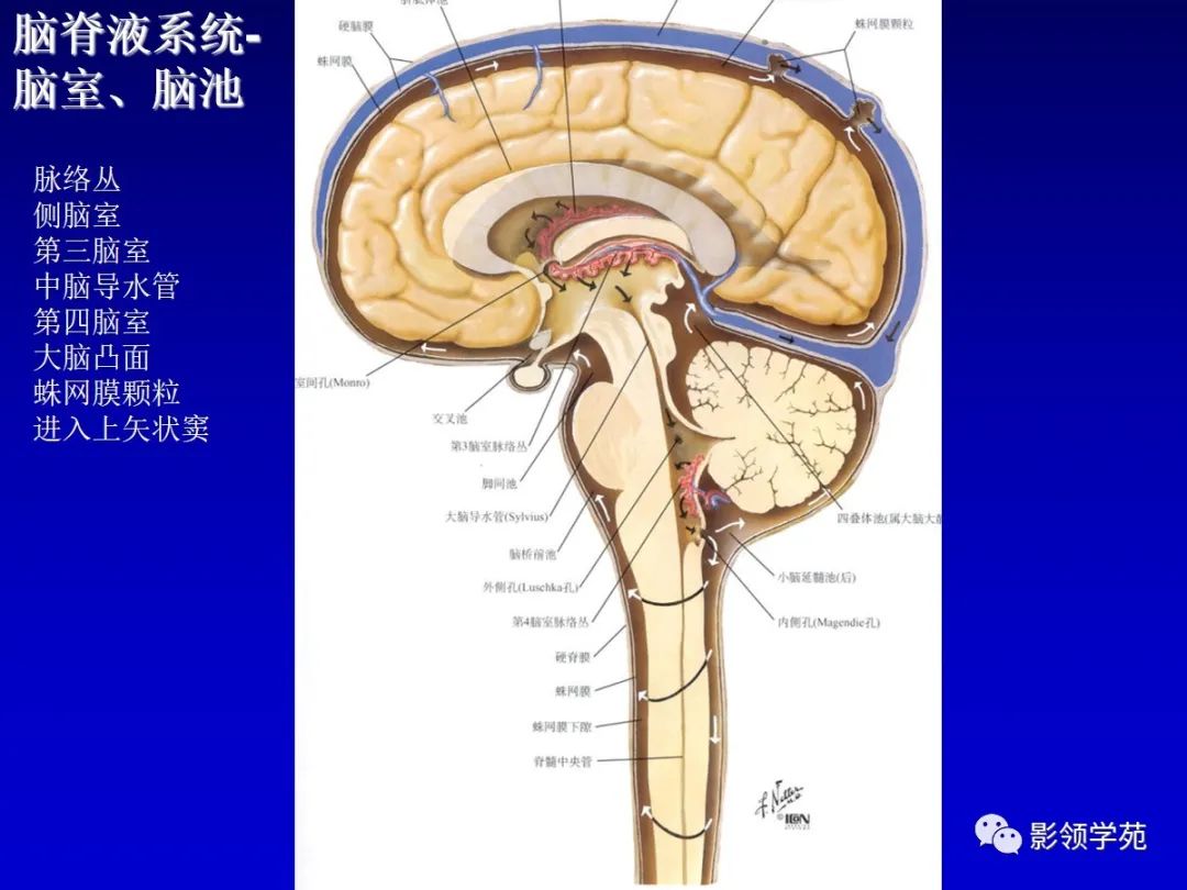 影像PPT - 新生儿颅脑MRI解剖及常见疾病影像表现-68 影像PPT - 新生儿颅脑MRI解剖及常见疾病影像表现-68
