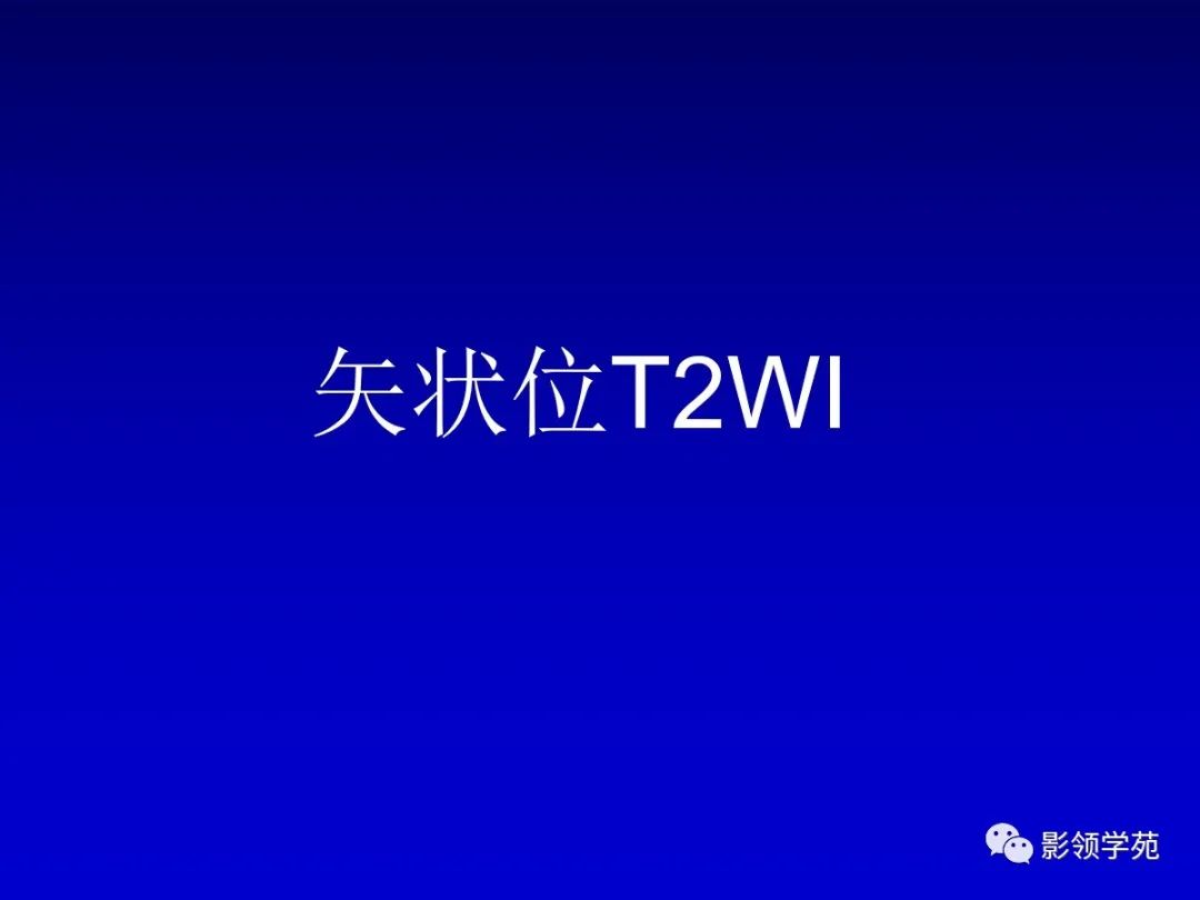 影像PPT - 新生儿颅脑MRI解剖及常见疾病影像表现-75 影像PPT - 新生儿颅脑MRI解剖及常见疾病影像表现-75