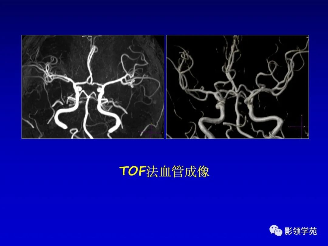 影像PPT - 新生儿颅脑MRI解剖及常见疾病影像表现-84 影像PPT - 新生儿颅脑MRI解剖及常见疾病影像表现-84
