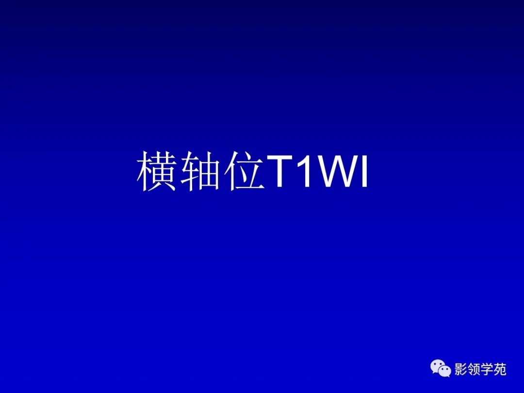 影像PPT - 新生儿颅脑MRI解剖及常见疾病影像表现-102 影像PPT - 新生儿颅脑MRI解剖及常见疾病影像表现-102