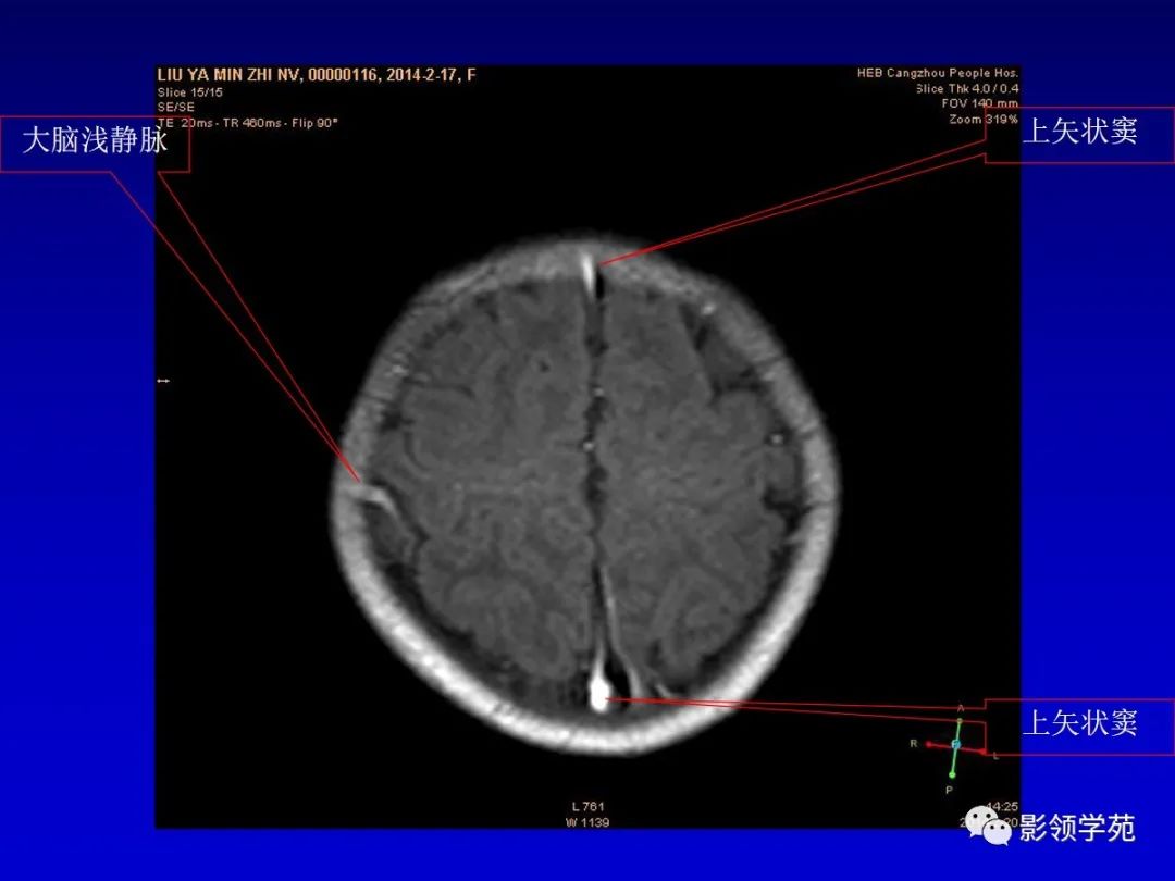 影像PPT - 新生儿颅脑MRI解剖及常见疾病影像表现-103 影像PPT - 新生儿颅脑MRI解剖及常见疾病影像表现-103