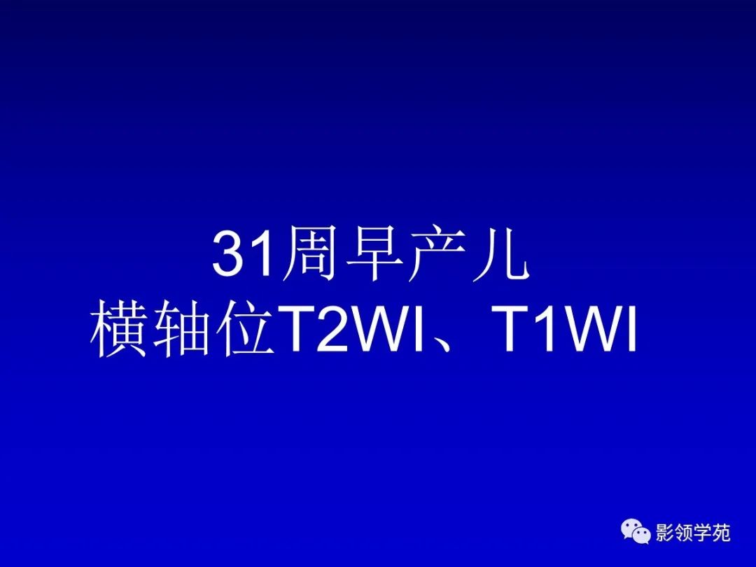 影像PPT - 新生儿颅脑MRI解剖及常见疾病影像表现-137 影像PPT - 新生儿颅脑MRI解剖及常见疾病影像表现-137