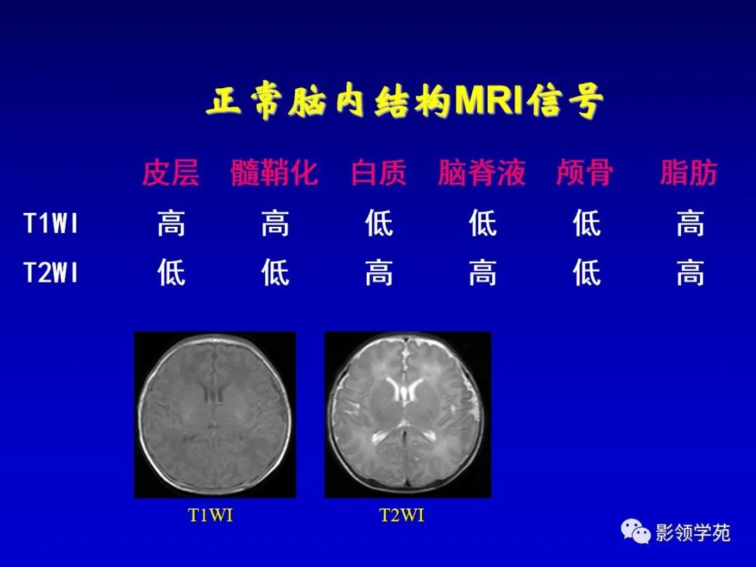 影像PPT - 新生儿颅脑MRI解剖及常见疾病影像表现-160 影像PPT - 新生儿颅脑MRI解剖及常见疾病影像表现-160