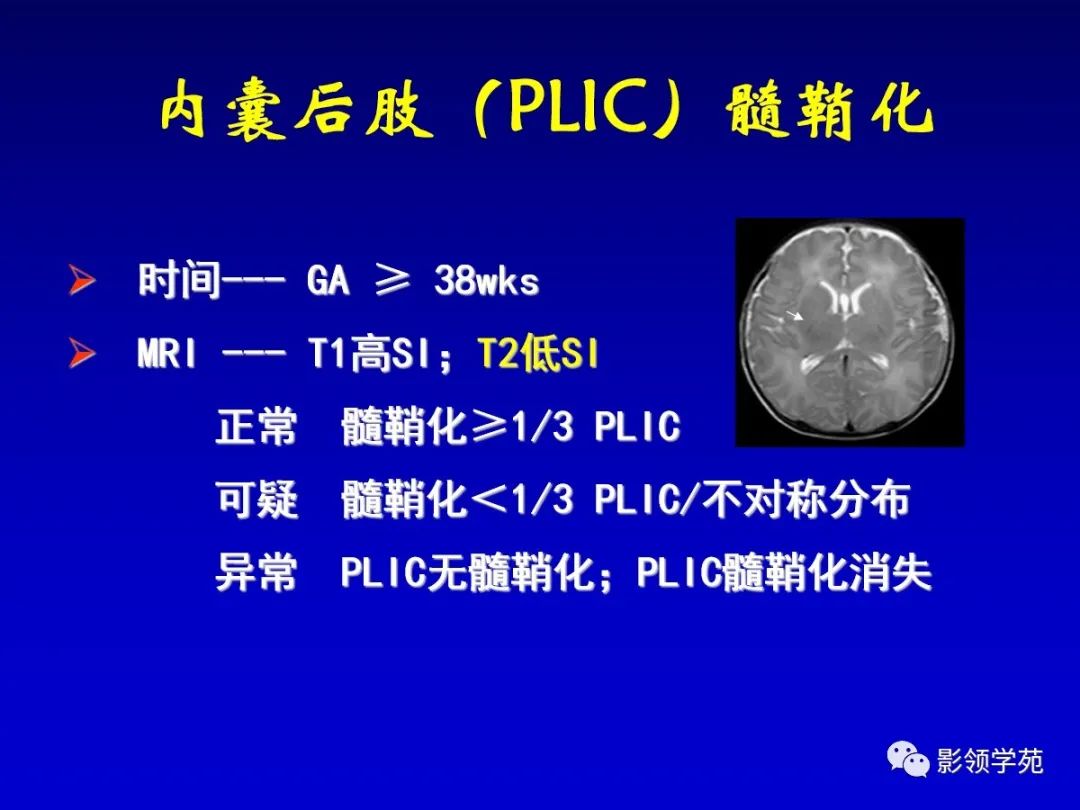 影像PPT - 新生儿颅脑MRI解剖及常见疾病影像表现-181 影像PPT - 新生儿颅脑MRI解剖及常见疾病影像表现-181