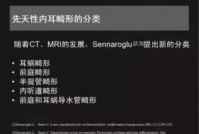 影像PPT - 【PPT】先天性内耳畸形影像学诊断-4