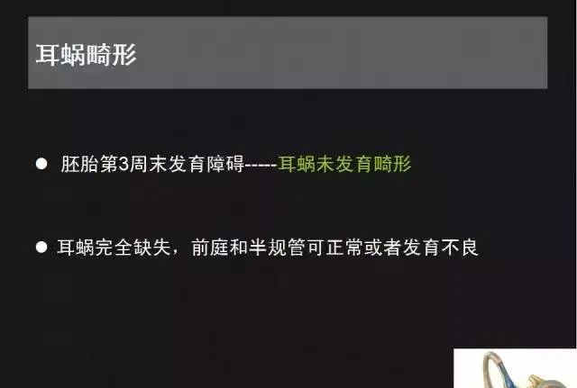 影像PPT - 【PPT】先天性内耳畸形影像学诊断-12