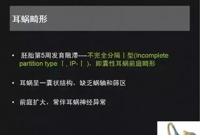 影像PPT - 【PPT】先天性内耳畸形影像学诊断-17